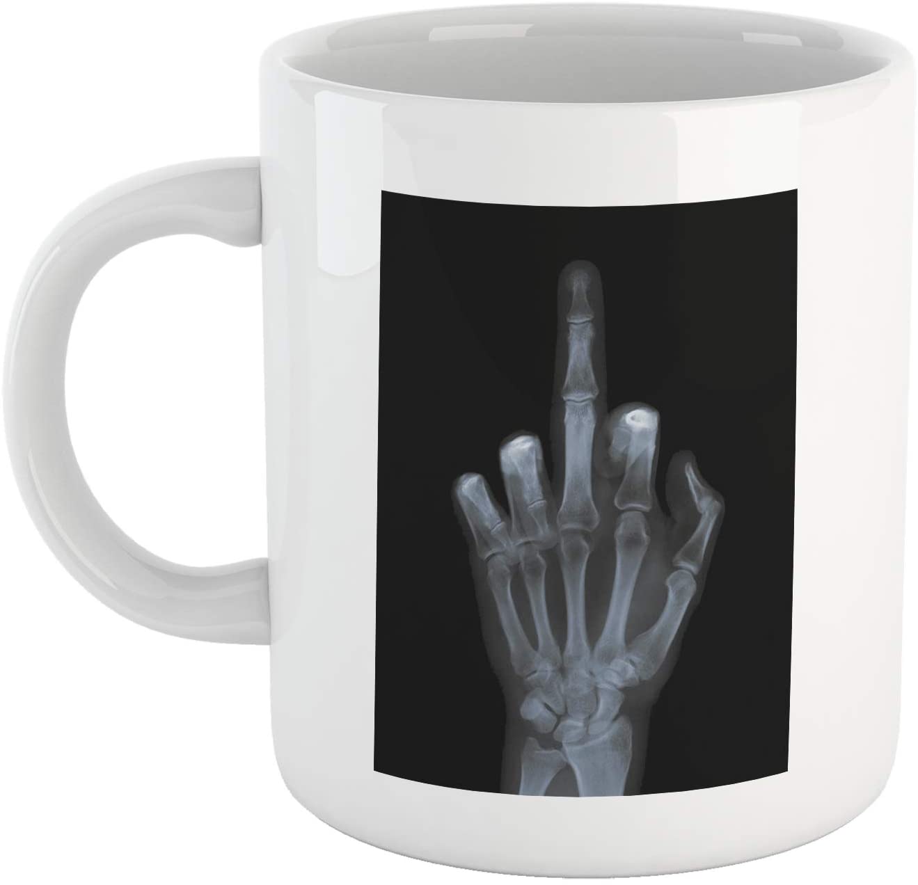 Black Tazza Radiografia Mano Ghigno - Mug Simpatica - Choose Ur Color Cuc shop